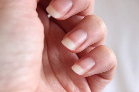 Home Remedies For Stronger Nails1