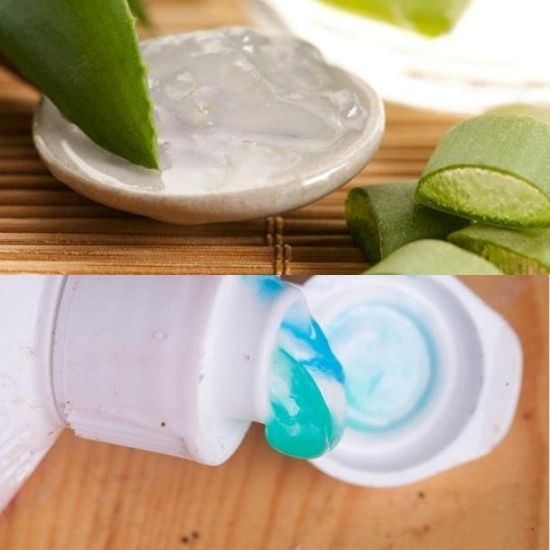 Aloe Vera and Toothpaste for Acne2