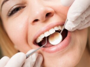 Home Remedies to Remove Cement From the Teeth ⋆ Helth