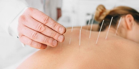 Pros and Cons of Dry Needling2