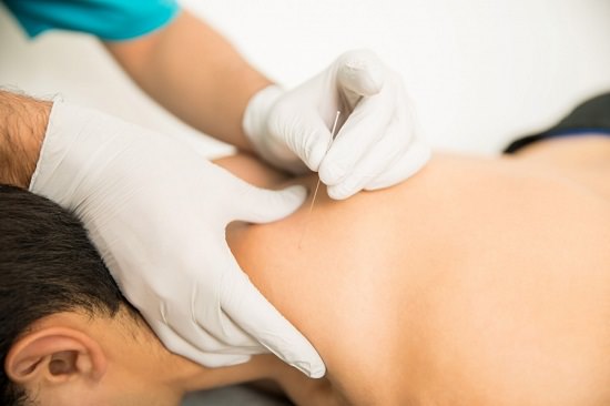 Pros and Cons of Dry Needling1